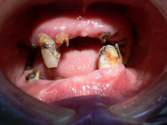 お口の病気予防とサプリメントについて