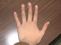 MY hand