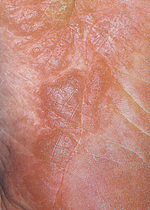 肌トラブル（体、四肢、足編）：皮膚科、形成外科、美容皮膚科別